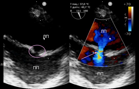 Рисунок 4 Рисунок 4