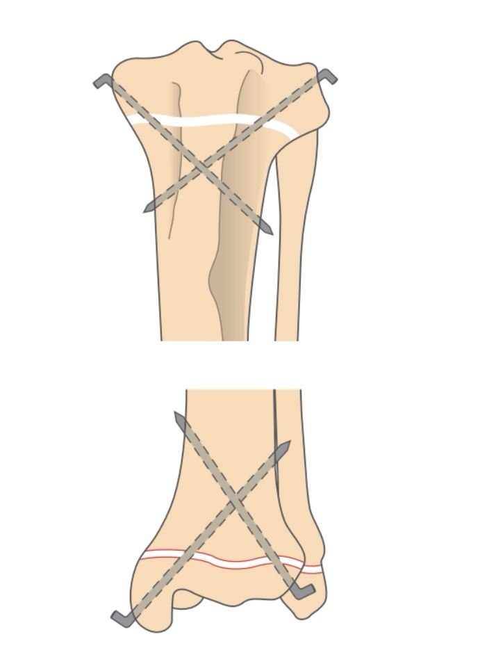 Рис. 2 Рис. 2
