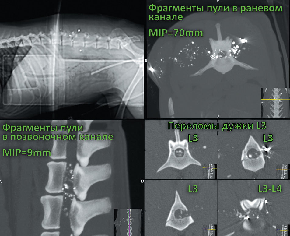 Оружейные черепно-мозговые ранения мирного времени