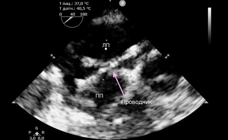 Рисунок 2 Рисунок 2
