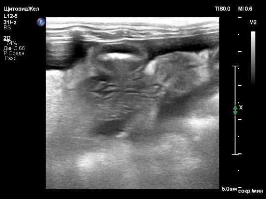 Фото 4.2 Фото 4.2