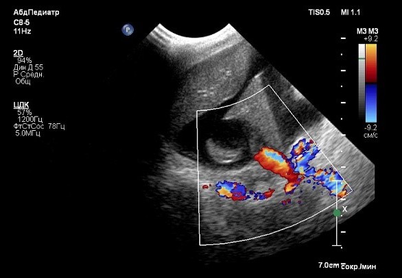 Фото 4.1 Фото 4.1